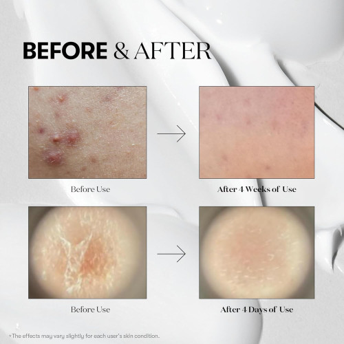 VT Cosmetics Reedle Shot 100 - 50ml