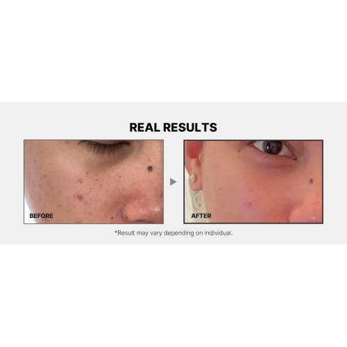 Medicube Deep Vita C Ampoule 2.0 30g