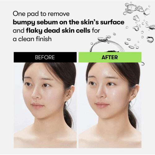 VT Cosmetics Reedle Shot Synergy Sparkling Toner Pad 200ml